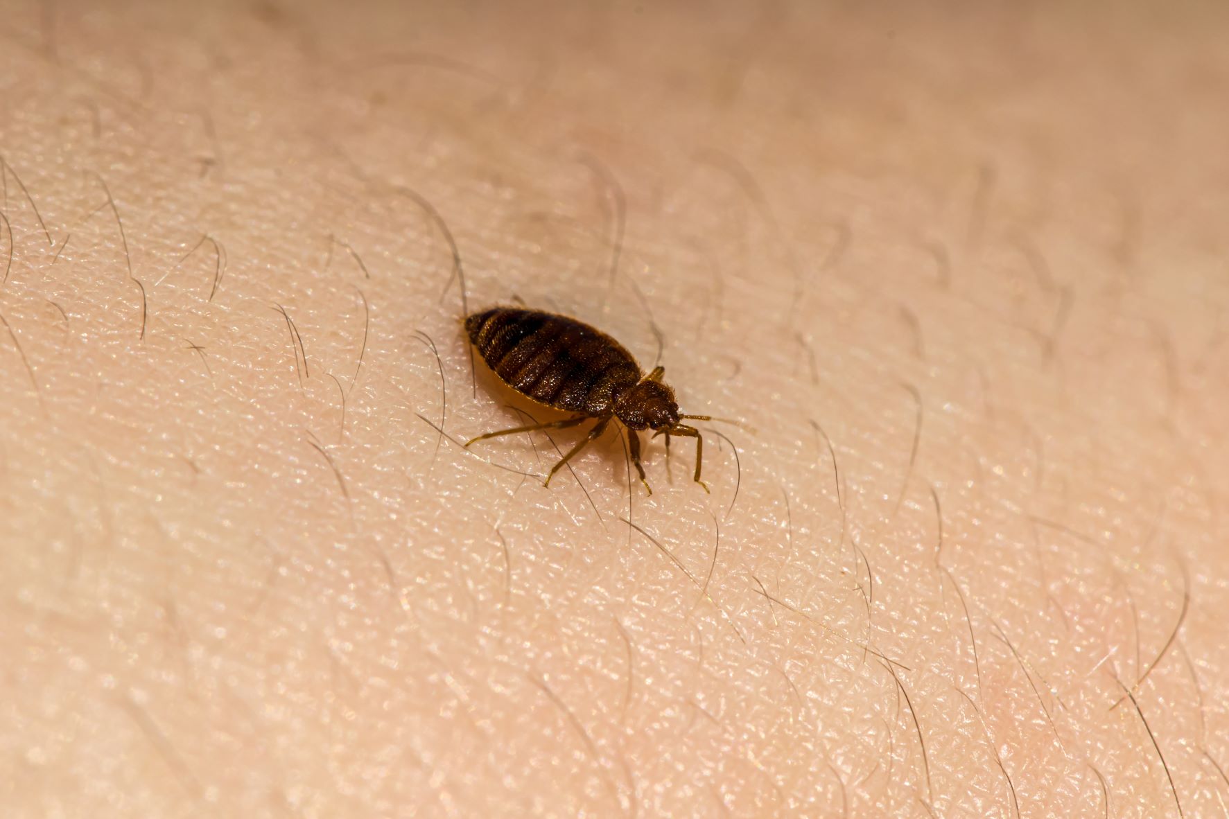 Bed bug standing on skin surrounded by hair